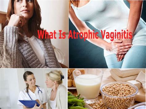 What Is Atrophic Vaginitis Symptoms And Management