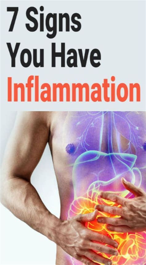 7 Signs You Have Inflammation Page 23 Of 23 In 2020 With Images