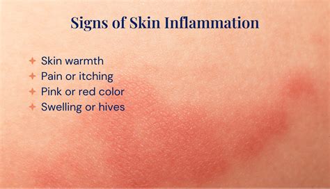 What Is Skin Inflammation Is There A Cure Skin Type Solutions