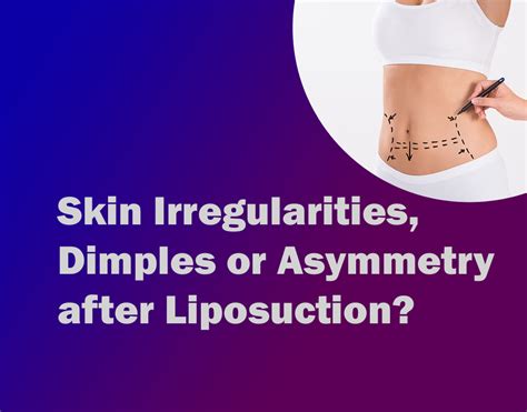 Causes Of Skin Irregularities After Liposuction Surgery