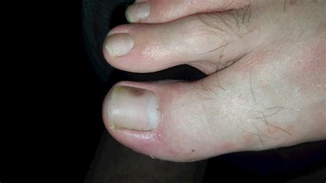 A healthy toenail is smooth, consistent in color, and generally pinkish. Black Dot Under My Toenail - nail decorations