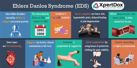 Hypermobile Ehlers Danlos Syndrome Diagnostic Criteria