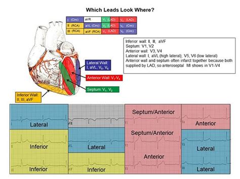 12 Lead Ecg Reference Chart Mx