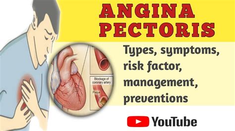 Angina Cause Symptom Treatment And More Medline Profession