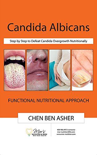Candida Albicans Step By Step To Defeat Candida Overgrowth
