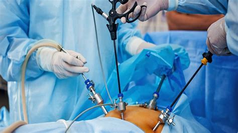 An inguinal hernia repair can be carried out as either open surgery or laparoscopic (or keyhole) a mesh is placed in the abdominal wall, at the weak spot where the hernia came through, to keyhole surgery tends to have a quicker recovery time in people who: Klfc Laparoscopy