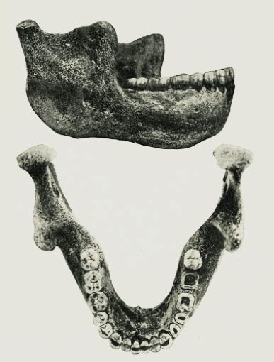 Photograph Of A Lower Jaw From Heidelberg After A Photograph By