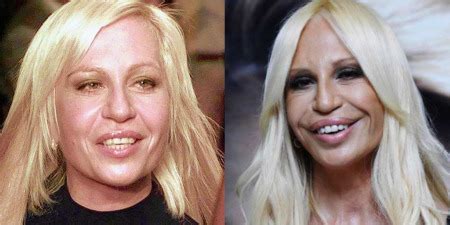 Donatella versace biography with personal life (affair, boyfriend , lesbian), married info (husband, children, divorce). ELIXIR SAGRADO DEL ESCORPION: HORRORES DE LA CIRUGIA PLASTICA