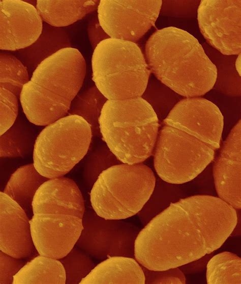 Streptococcus Pneumoniae 3 Photograph By Dennis Kunkel Microscopy