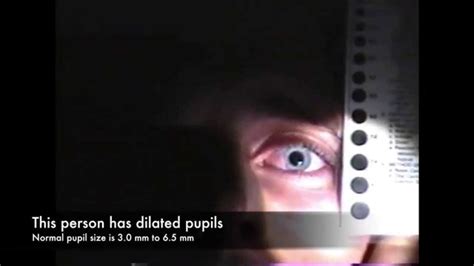 Dilated Pupils And Drug Influence Youtube