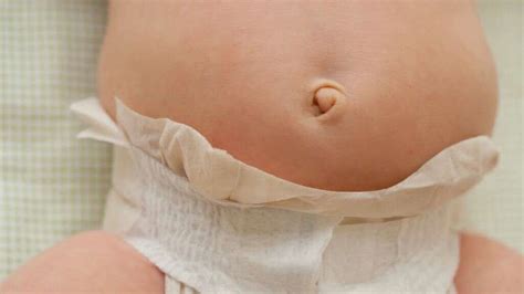 Belly Button Infection What Is A Belly Button Infection