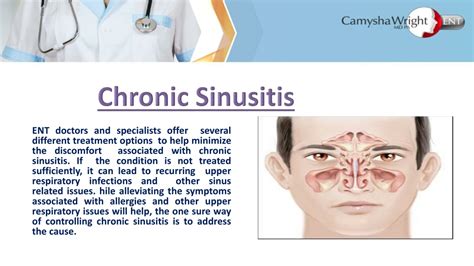 ppt dr camysha wright treatment of chronic sinusitis powerpoint presentation id 10876368
