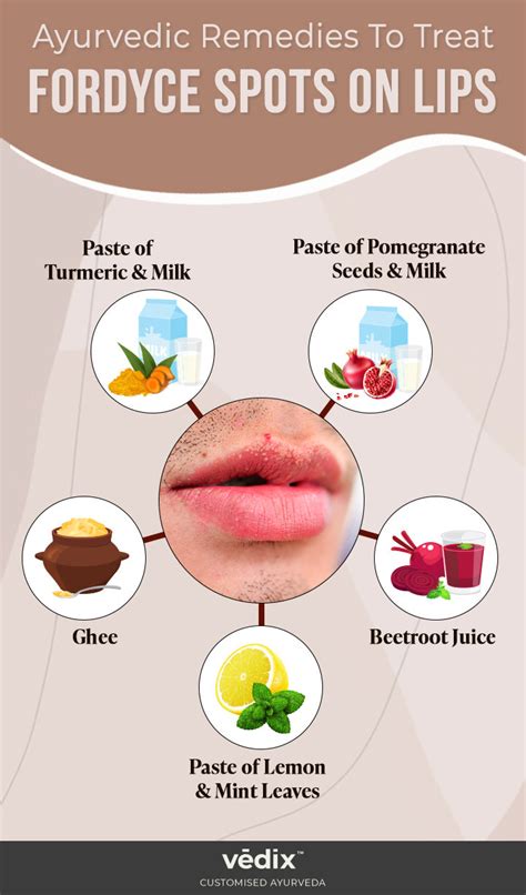 Fordyce Spots On Lips How Does It Look Causes And Treatments Vedix