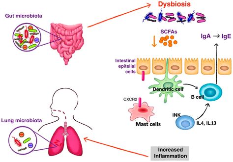 Using The Gut Microbiome To Understand And Treat Respiratory Diseases