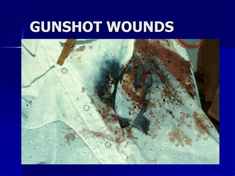 Wed, 27 feb 2013 | gunshot wounds. PPT - FORENSIC PATHOLOGY PowerPoint Presentation, free ...