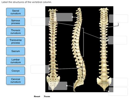 Solved Label The Structures Of The Vertebral Column Sacral Chegg Com