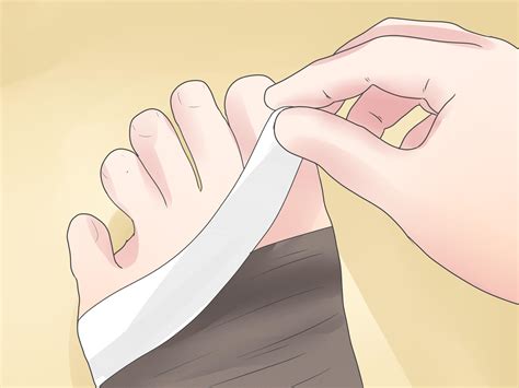 4 Ways To Treat A Sprained Ankle Wikihow