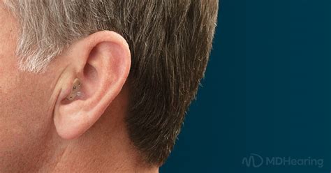 In Ear Hearing Aids Pros Cons Features And More