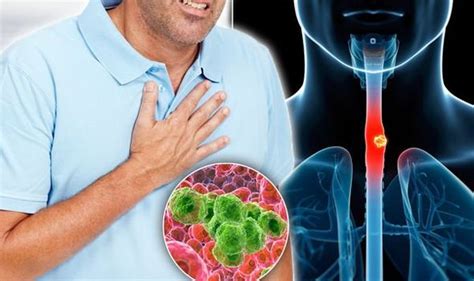Cancer Symptoms Signs Of Oesophageal Tumour Include Chest Pain And