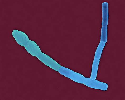 Bacillus Cereus Rod Prokaryote Photograph By Dennis Kunkel Microscopy