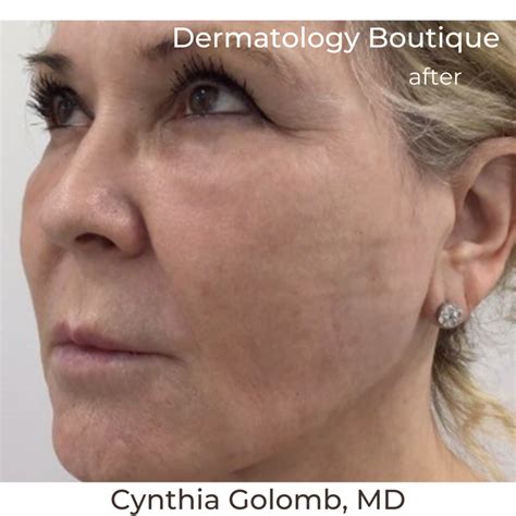 Festoon Update Cynthia Golomb Md Dermatology Boutique