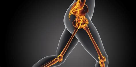 Hip injuries, hip disorders, and hip arthritis can result in severe hip pain that can only be alleviated with professional medical attention. Trochanteral Bursal Injections: Hip Pain Relief Procedure ...