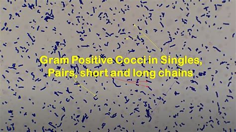 Gram Positive Cocci In Singles Pairs Short And Long Chains