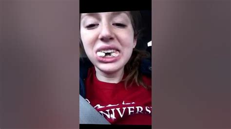 Tina Got Her Wisdom Teeth Removed Youtube