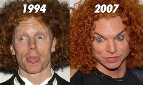 Most Outrageous Plastic Surgery Fails Faculty Of Medicine