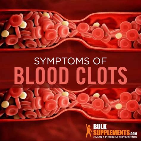 Blood Clots Symptoms Causes And Treatment