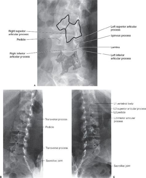 9 Spine And Pelvis Radiology Key