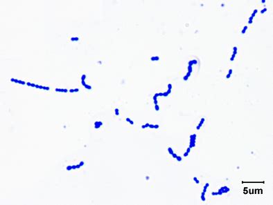 Biol Lab Manual Gram Stain Of Streptococcus Pyogenes