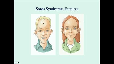 Sotos Syndrome Crash Medical Review Series Youtube