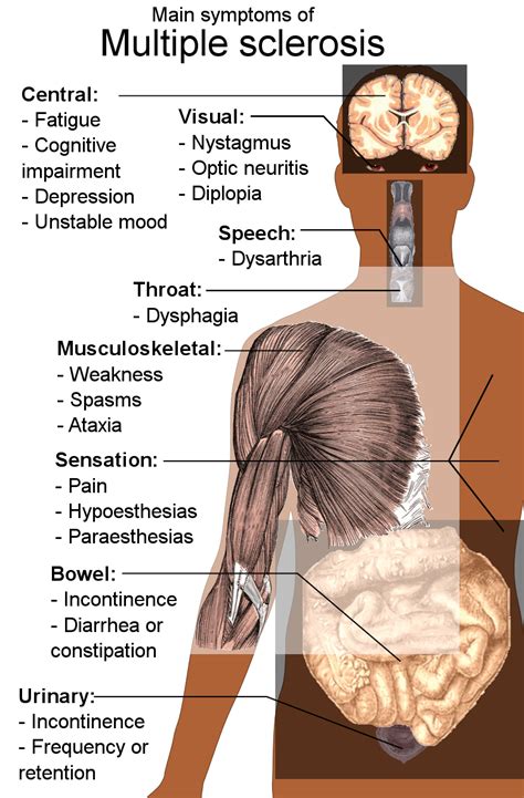 Multiple sclerosis information including symptoms, diagnosis, treatment, causes, videos, forums, and local community support. Symptoms, Causes and Treatments of MS - Harrow MS Therapy ...