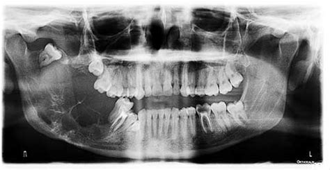 Com March 2018 Diagnosis Uw School Of Dentistry