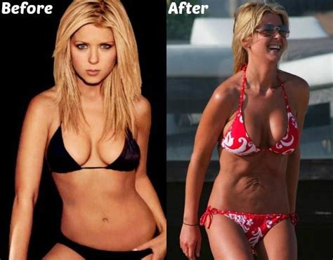 Is For Sale Celebrities Before And After Before And After Liposuction