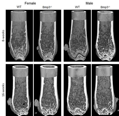 Bmp3 Affects Mice Cortical And Trabecular Bone Development
