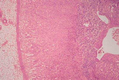 Histology World Key Histology Features Adrenal