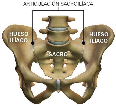 Dolor Sacro Iliaco O Sacroileítis Causas Y Tratamiento