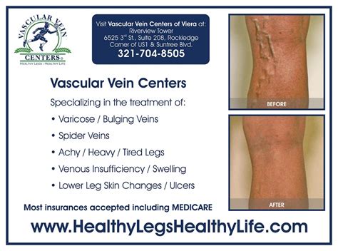 Vascular Vein Centers Web 20 Directory
