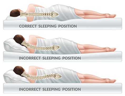 Best Sleeping Position For Neck Pain Alleviate Discomfort And Improve