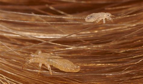 Head Lice Treatment How To Get Rid Of Eggs And Nits For Good Using A