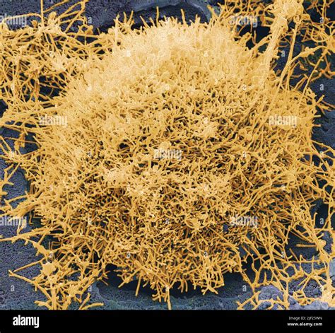 Ebola Virus Coloured Scanning Electron Micrograph Sem Of Ebola Virus