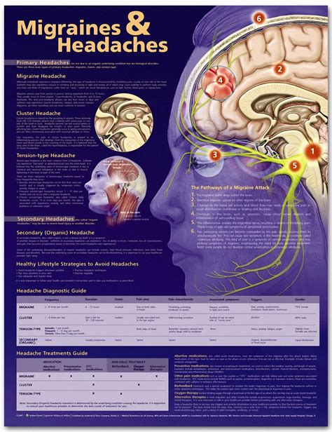 Pin By Jeanette Cole On Migraineheadaches Headache Types Headache