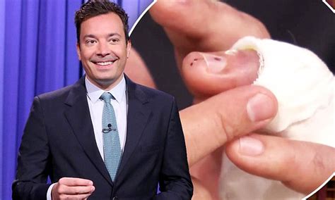 Jimmy Fallon On His Hand Injury In Freak Fall As He Returns To Tonight