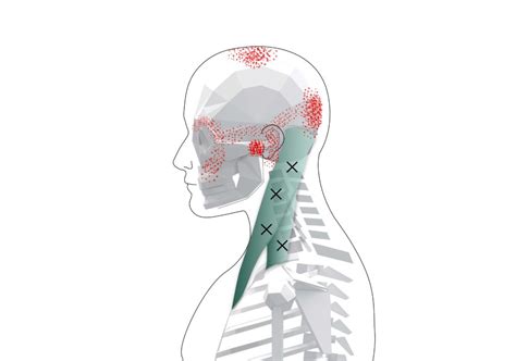 Sternocleidomastoid Trigger Points Overview And Self Treatment