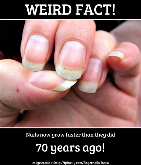 Nails Now Grow Faster Than They Did 70 Years Ago Fun Facts You Need