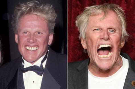 Gary Busey Before And After Accident What Happened Wife And Net Worth
