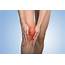 Home Remedies For Joint Pain