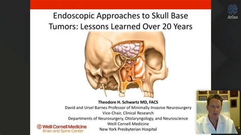 Endoscopic Skull Base Surgery Lessons Learned Grand Roundsvirtual